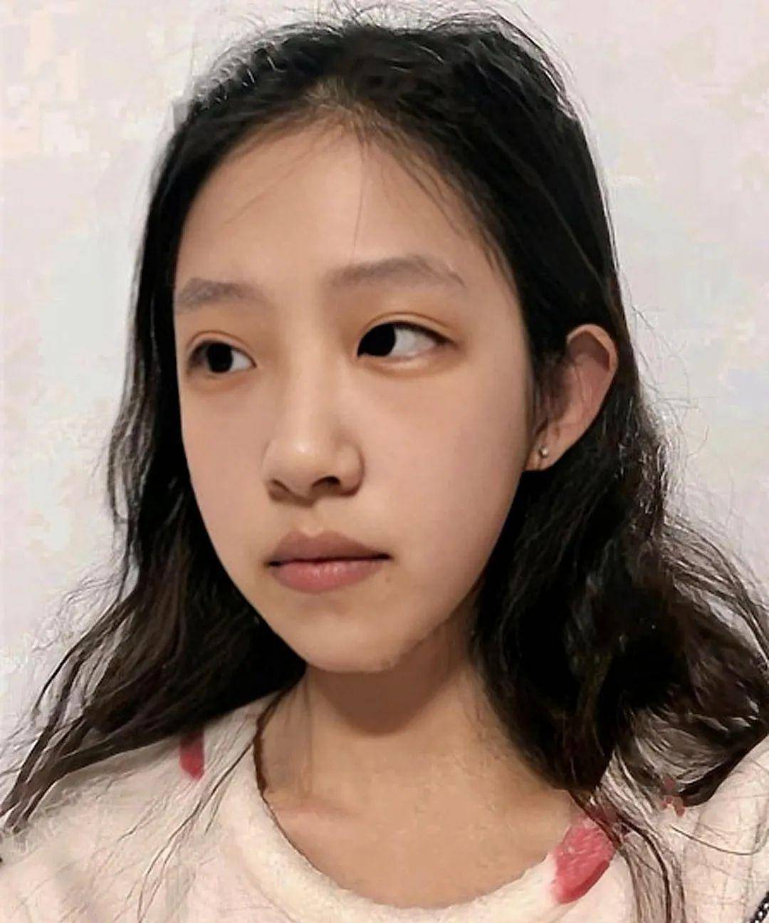 丑是真|她他们的鼻子到底丑在哪儿？