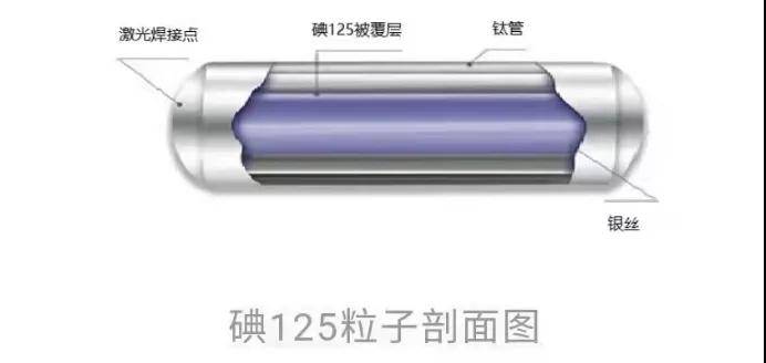肿瘤|咸阳市中心医院开展不开刀颅内肿瘤放射性粒子植入术
