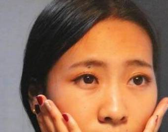 肝脏|肝不好的人，一旦身体再有这几种“丑态”，说明肝已开始“硬化”