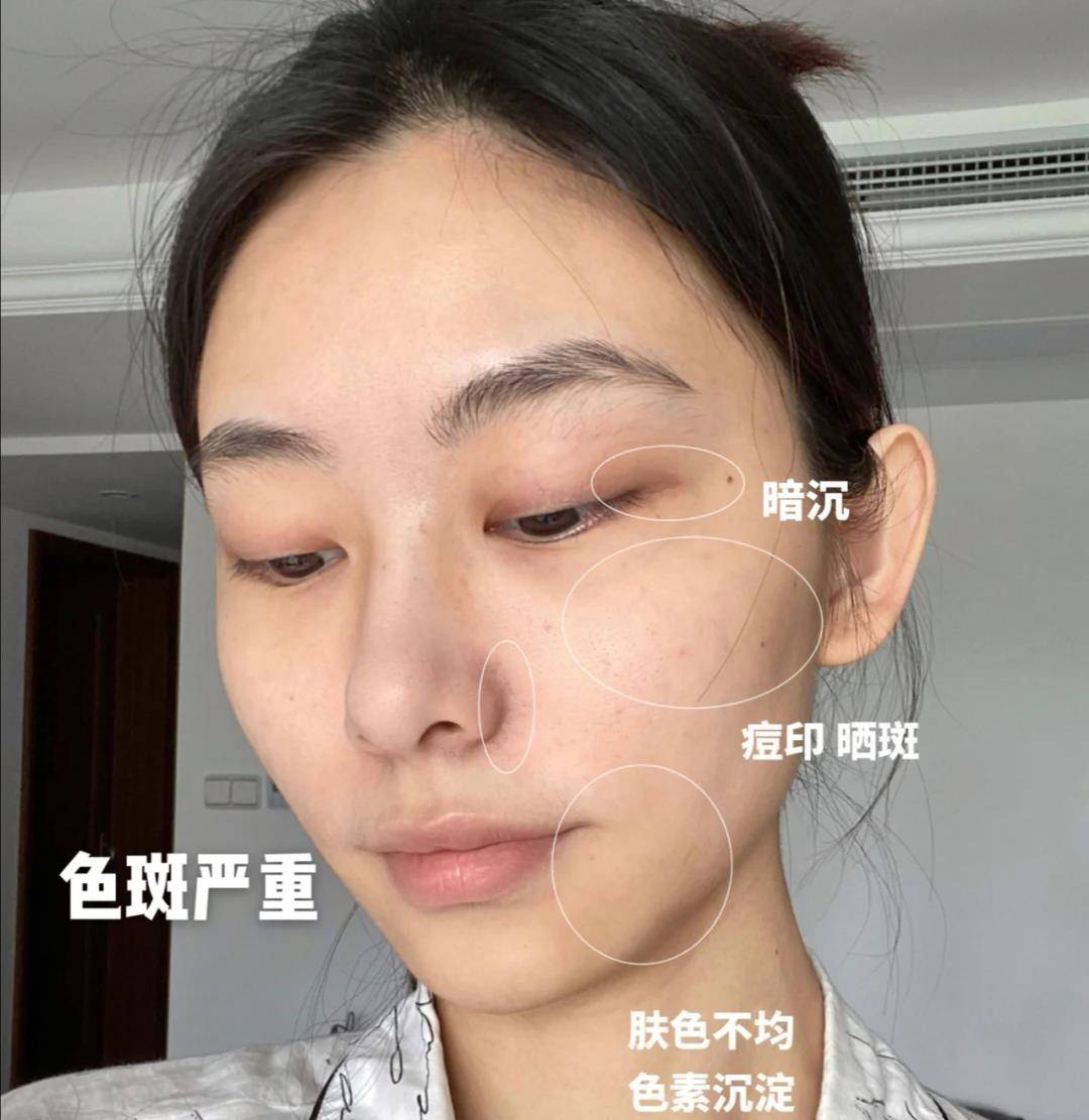 眼睛|女人有这些特征比较显老，看看你有没有，没有的女人很幸运