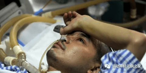 方向|运动神经元病治疗，宁缺勿滥运动神经元治疗方向一定要正确选择！