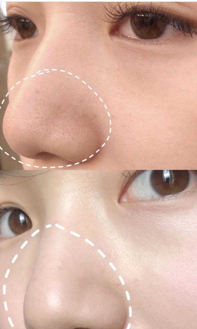 黑头|金晨是牛奶“泡大”的？穿吊带裙藏不住“水光肌”皮肤嫩得要出水