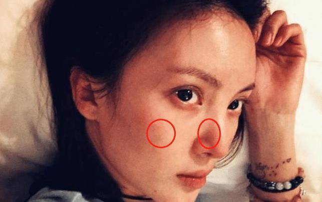 黑头|金晨是牛奶“泡大”的？穿吊带裙藏不住“水光肌”皮肤嫩得要出水