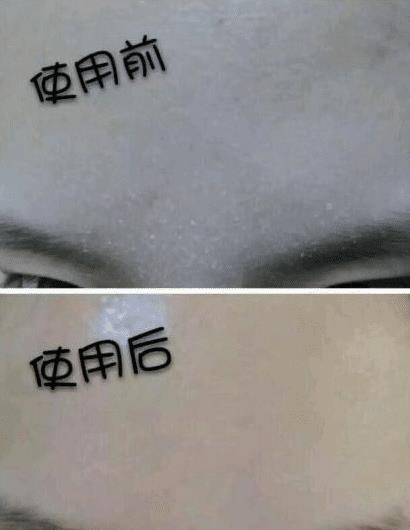 黑头|金晨是牛奶“泡大”的？穿吊带裙藏不住“水光肌”皮肤嫩得要出水