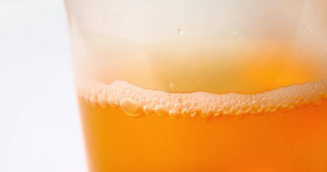 电脑|在睡觉前爱玩手机的人，身体若出现这4种情况，需注意一下