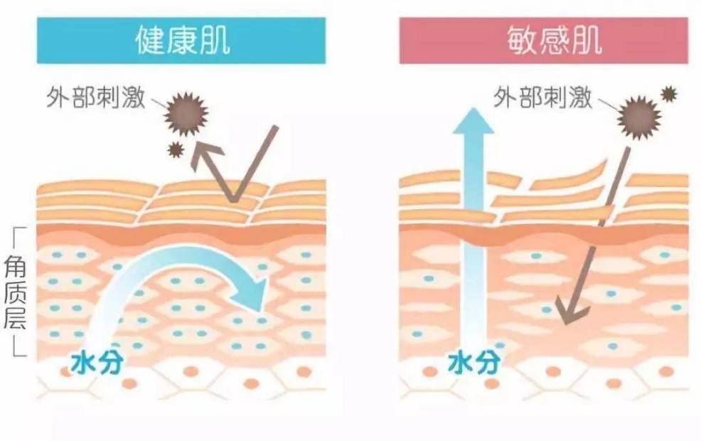 双抗敏感肌的维稳抗衰——AI·氢抗氧