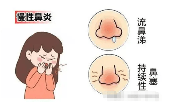 43c3bdb4dd19491cba164216a60feb2d.png