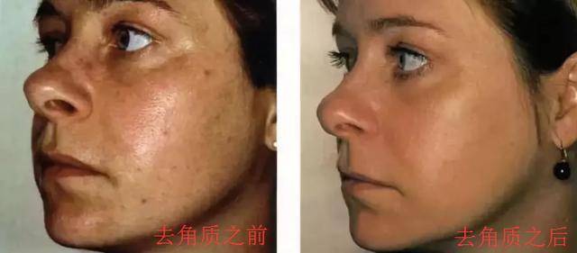 黄圣依37岁黄圣依素颜美到“心儿颤”！她推荐的护肤好物，张韶涵也说好
