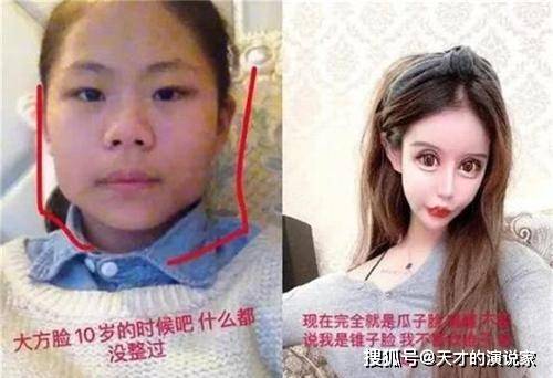 事情还记得花百万整容的网红女孩吗？3年整了百次，如今前后判若两人