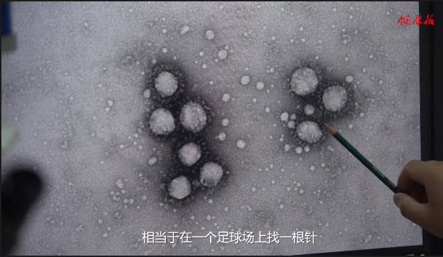 hpv病毒是什么引起的带你了解真实情况 a5848bd4ea4a423d8ea9d33b99fdcd49.jpeg