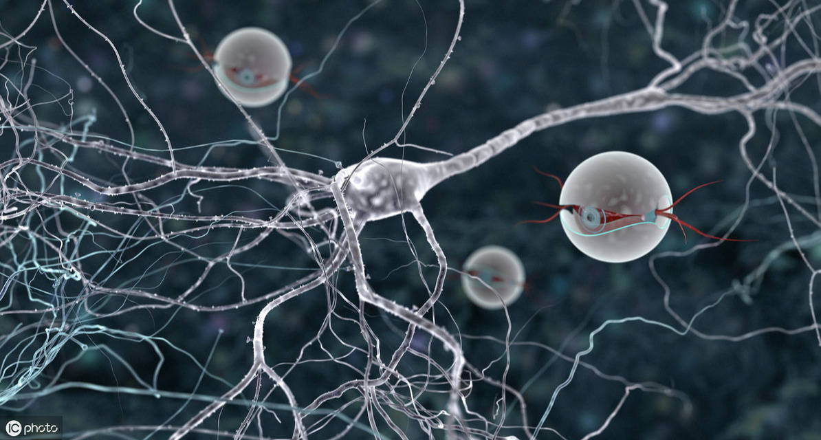 人工神经网络的特点有哪些