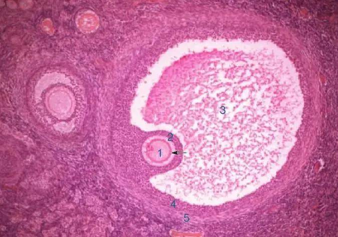 促排卵为什么要吃二甲双胍?