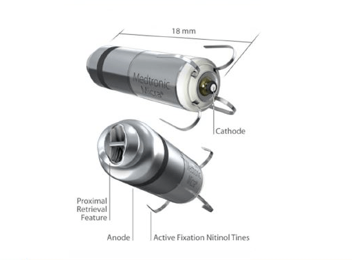 首例|小体积大能量 ▏市三院心血管内科成功完成首例无导线起搏器植入手术