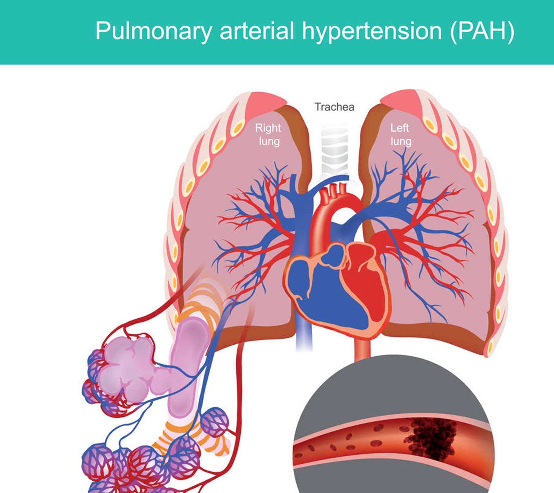 肾脏|35岁男子8年后肾衰，医生：警惕这种无声的疾病