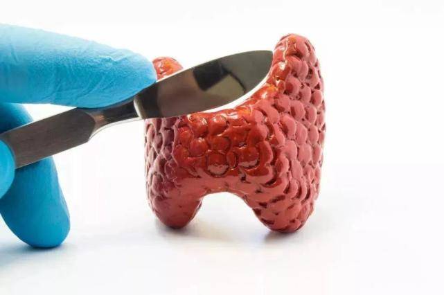 因为|王克珍专家:甲减患者要注意了,做好这4件事,有助于病情的恢复!