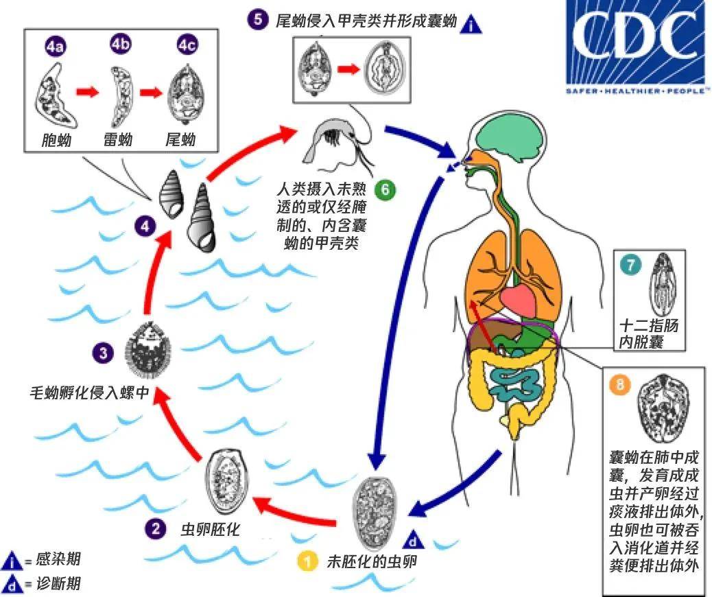 狐大医 广东女子体内钻出 活虫 爱吃这种美食等于生吞 虫窝 寄生虫