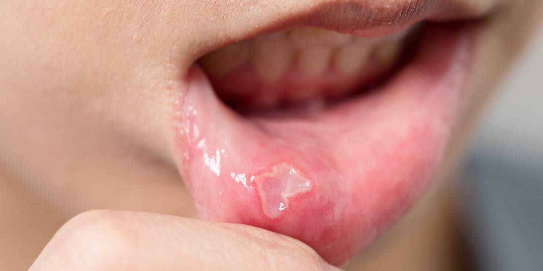 肾脏|6个症状可能是肾脏在呼救，发现后别拖着，赶紧去医院