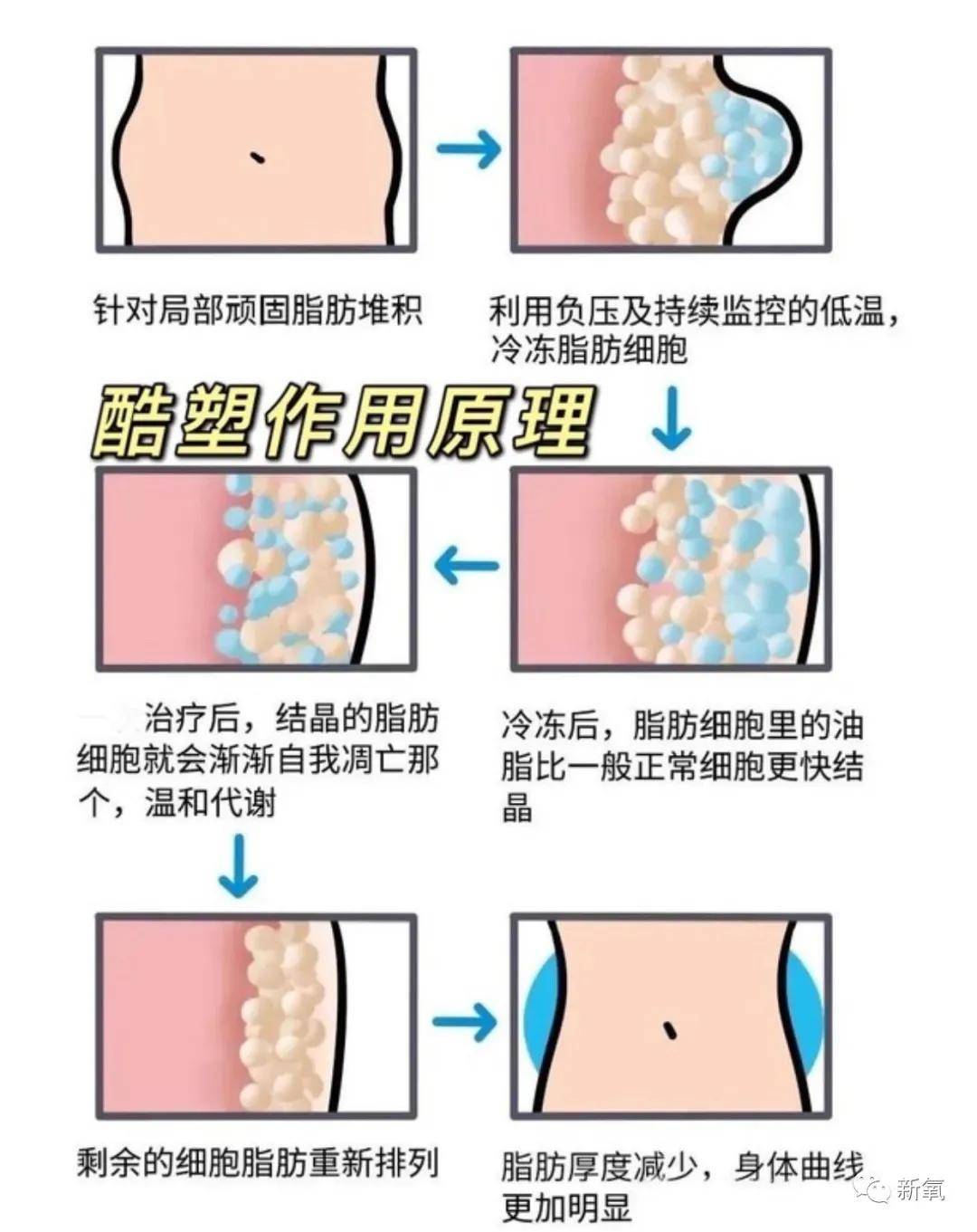 因为绝世美人因为冷冻溶脂毁容消失5年，轻医美没你想的那么轻！