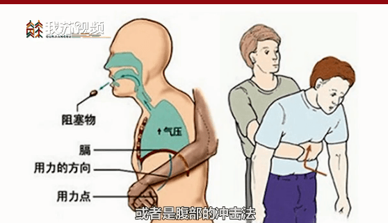 海姆|警惕！一男子含着话梅睡觉 话梅核卡进气道险丧命