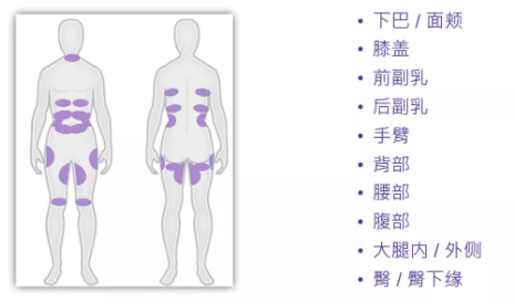 脂肪双下巴消失仅用3天，钻石超塑是怎么做到的？