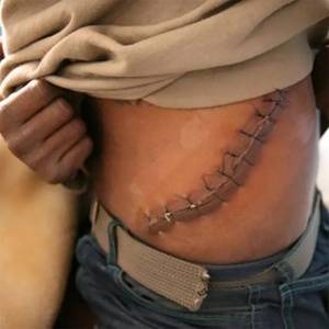 原创废弃厂房里的肾移植交易买肾人花55万卖肾人只得45万