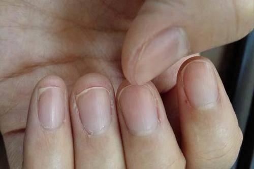 肝脏|肝好的人，看手“先知晓”？医生：手上有4个“迹象”，说明肝不错