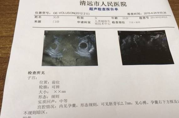 产检b超单数值有没可能错 83d80eff47624d339fa128add7b1a3ac.jpeg