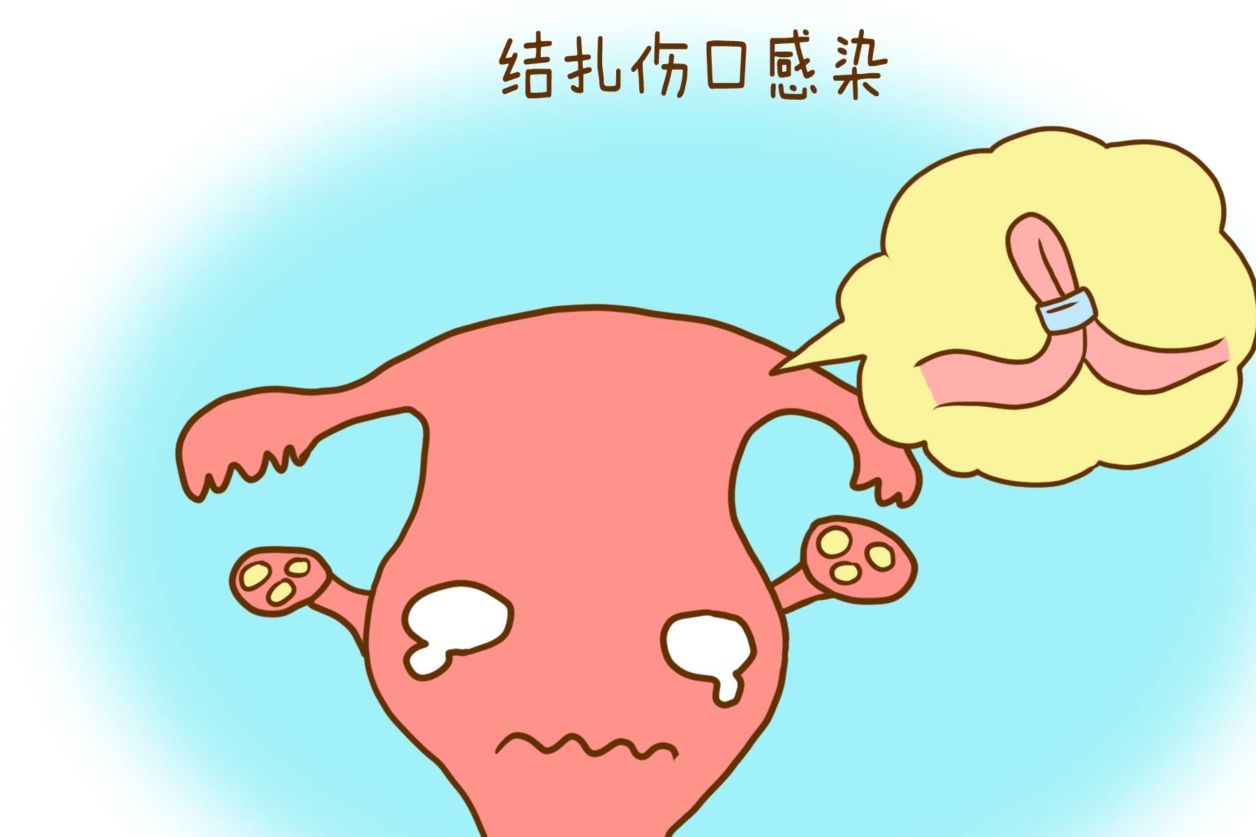 莉莉|生下孩子之后，是选择结扎还是上环，看看过来宝妈是怎么说的