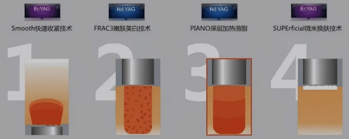 玛吉卡戴珊同款欧洲之星效果怎么样,为什么说欧洲之星效果不太行