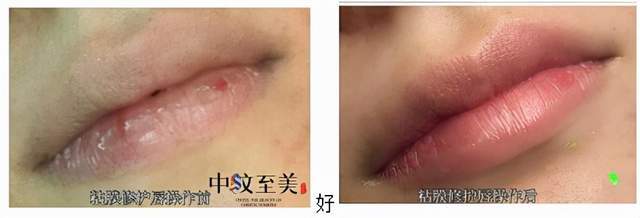 技术中纹至美郭娟娟——技术创新是行业人的使命