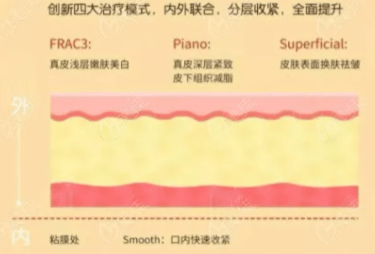 玛吉谈一谈，Fotona 4d和热玛吉区别，欧洲之星效果，到底怎么选