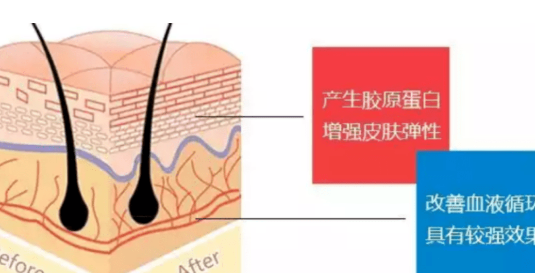 人群线雕和拉皮手术哪个好？别光说好的，必须上点大家不知道的菜！