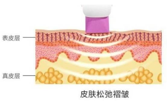 人体吃胶原蛋白的都是傻白甜吗？请看数据说话吧