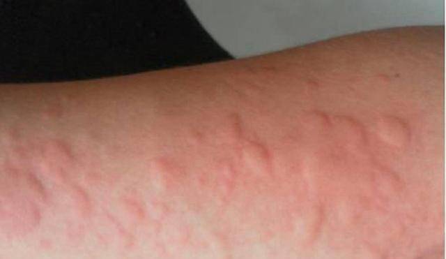 肝脏|想要保养肝脏,尽量要记住三点,进来了解下