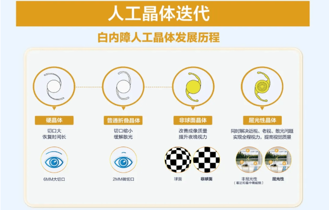 眼科手术费用一览 2d90918914794de4893f5dfed4350072.png