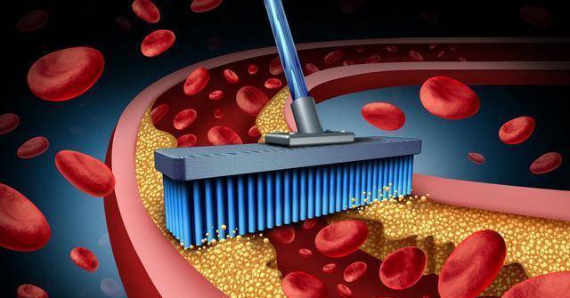 他汀|我对那个动脉有斑块的人说，最好不要停用他汀，原因是什么？