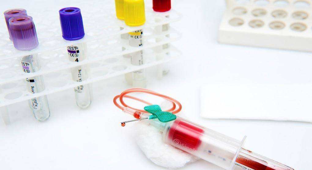 他汀|阿托伐他汀的服用周期是多久,可以长期吃么,能不能停药呢