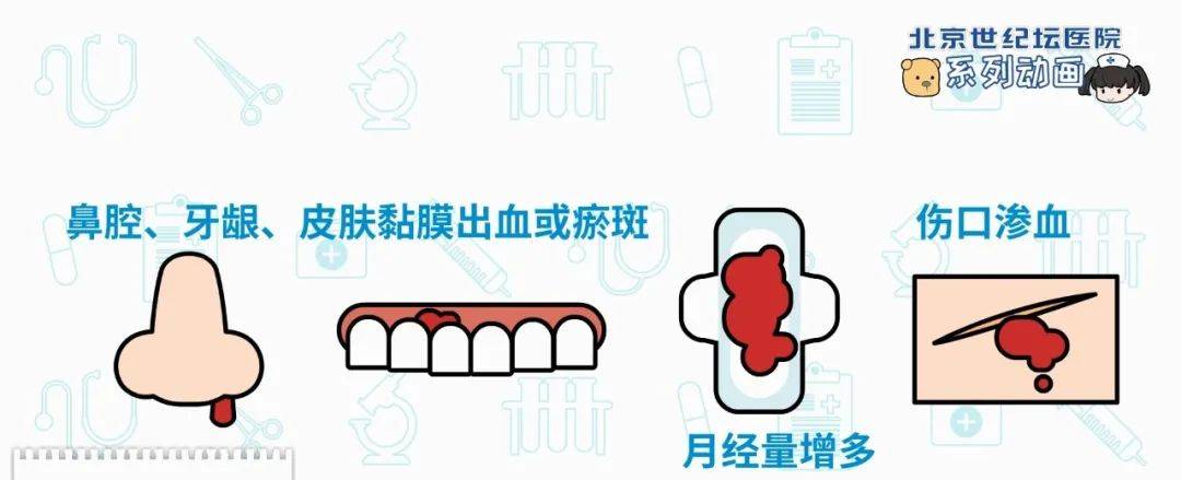 治疗|【科普动画】淋巴管静脉吻合术 术前术后要做啥？