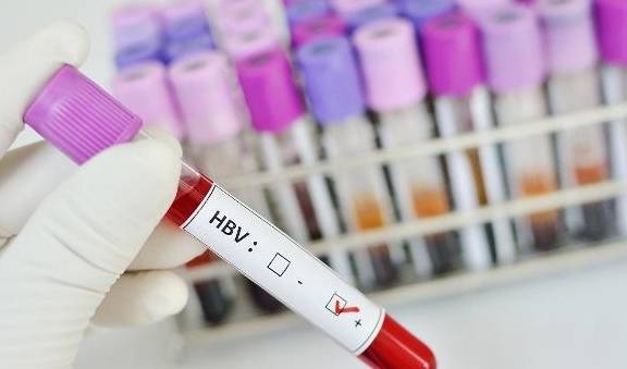 敌人|开诚布公地说：4种食物是乙肝患者的“敌人”，要躲开