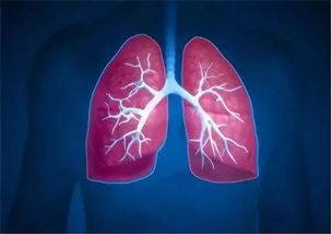 性医学|什么是间质性肺炎？如何预防间质性肺炎？