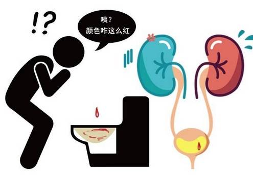 症状|肾不好，小便知道！提醒：若有这些现象，小心肾出问题了