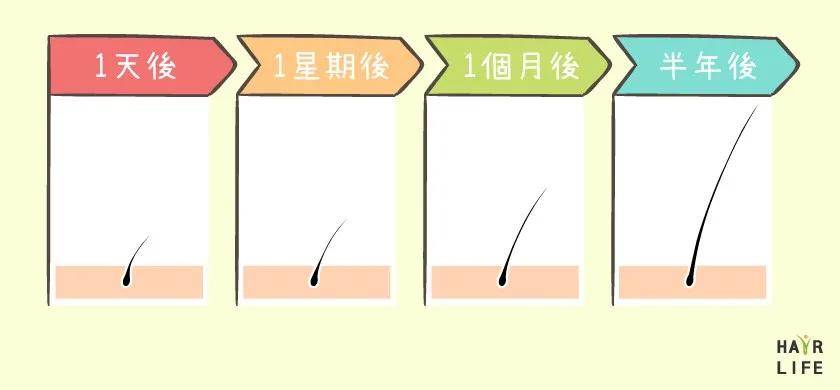 代谢|要是早知道这几招，最起码少掉几万根头发，心痛…