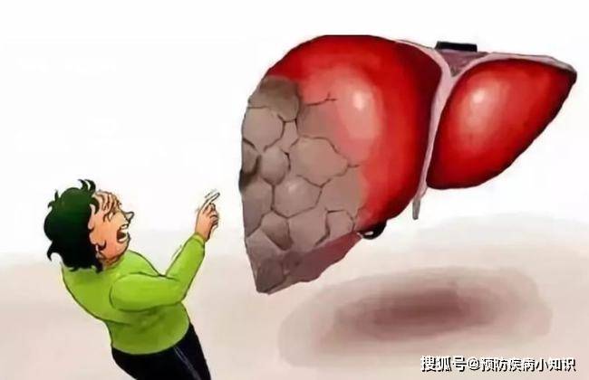 能够帮助|4种食物是肝脏“修复剂”，肝不好的人多吃些，肝脏或会更健康