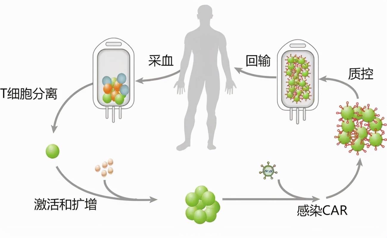 一文了解肿瘤免疫治疗界的黑马:car-t细胞疗法_患者
