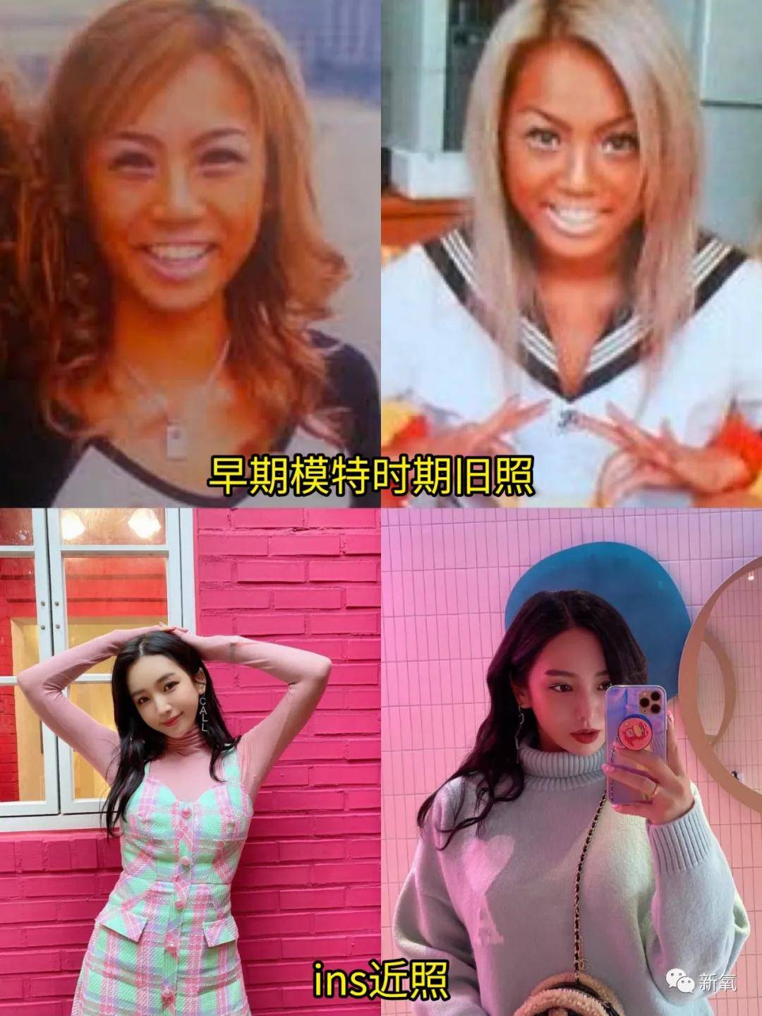 整形整形天选之人vs整完只会吓人，区别在哪里？