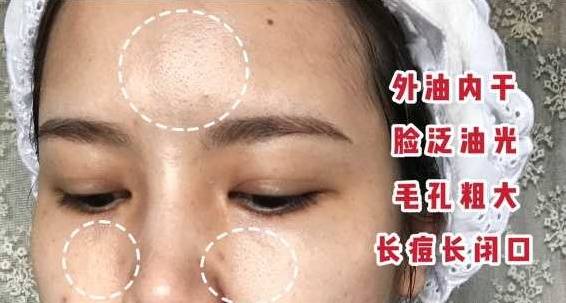 护肤品水媚蛙：皮肤暗黄、粗糙、肤色不匀？补水这步没就做对！
