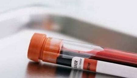 治疗|总有人说“得了肾病就会到尿毒症”，坚持这8个方法，怎么会毒？