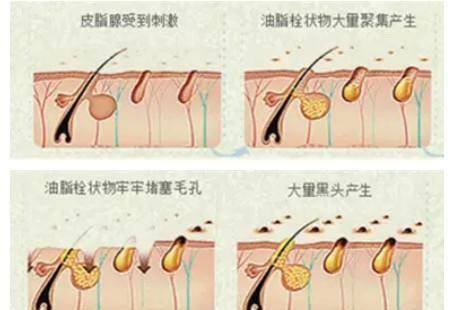 脸部脸部毛孔粗大？多半是螨虫作怪，坚持这个洗脸习惯，远离螨虫烦恼