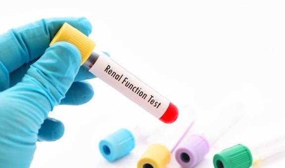 控制|糖尿病人尿液有泡沫?做2个检查3件事,心安一些