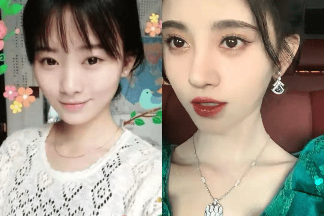 娄艺潇动脸的7位女星，一个比一个神奇，有人请医美专家鉴定自己纯天然